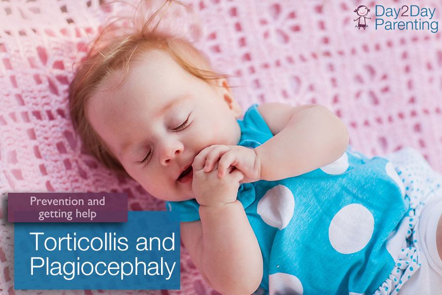 torticollis and plagiocephaly