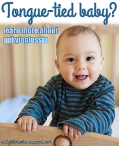 ankyloglossia or tongue tied child